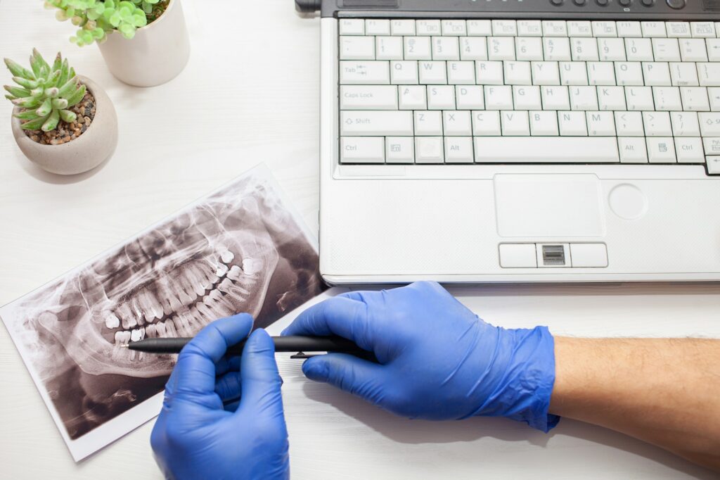 dentist in clinic examines x-ray of jaw of client's patient's teeth. modern technologies